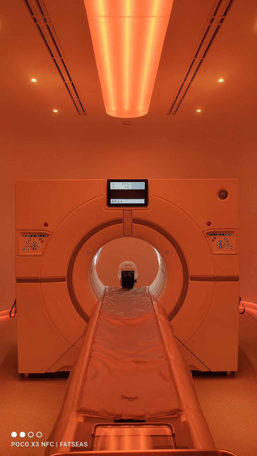 CT Scan Revolution